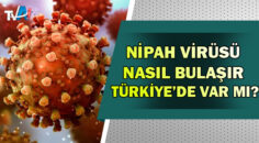 Nipah Virüsü Alarmı!İşte, Nipah virüsü belirtileri…